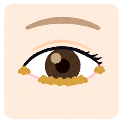 目ヤニが多く出た